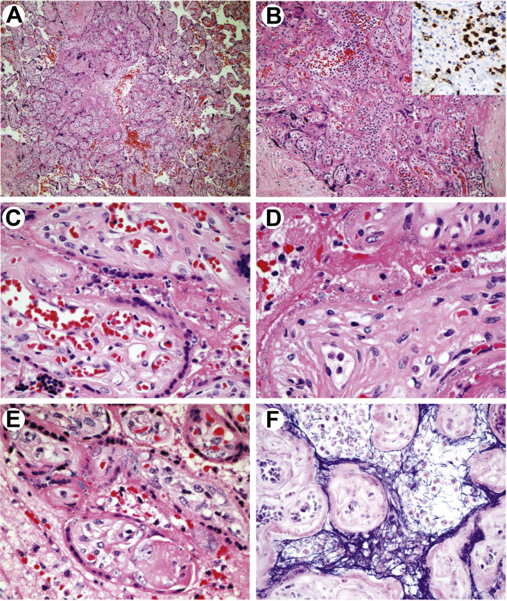 Fig. 1