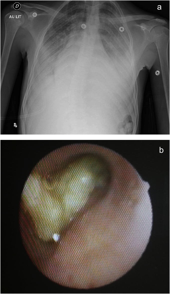 Fig. 1