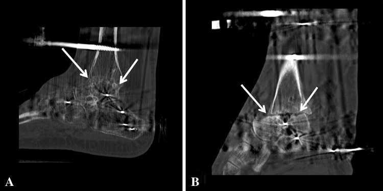 Fig. 2A–B