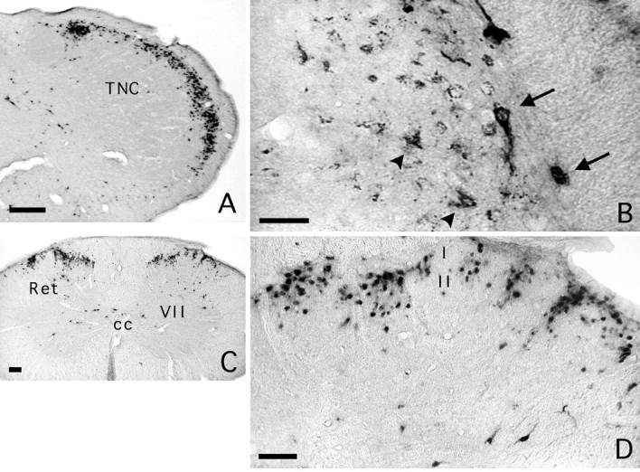 Fig. 12.