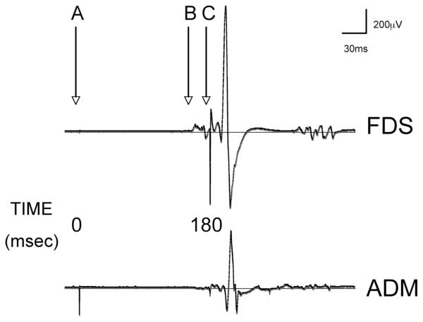 FIG. 1