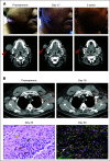 FIG 2.