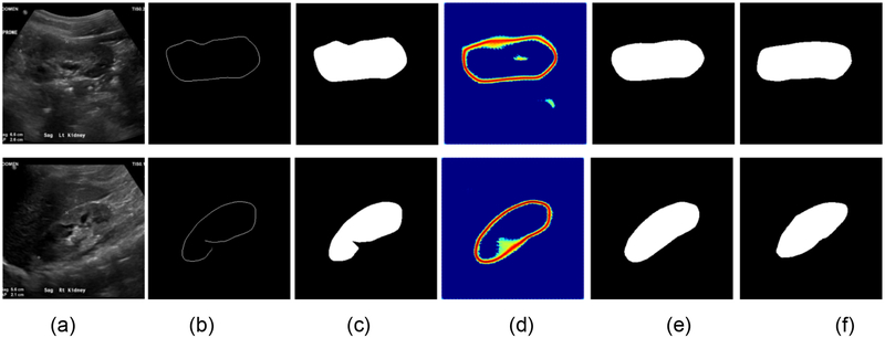 Fig. 14.