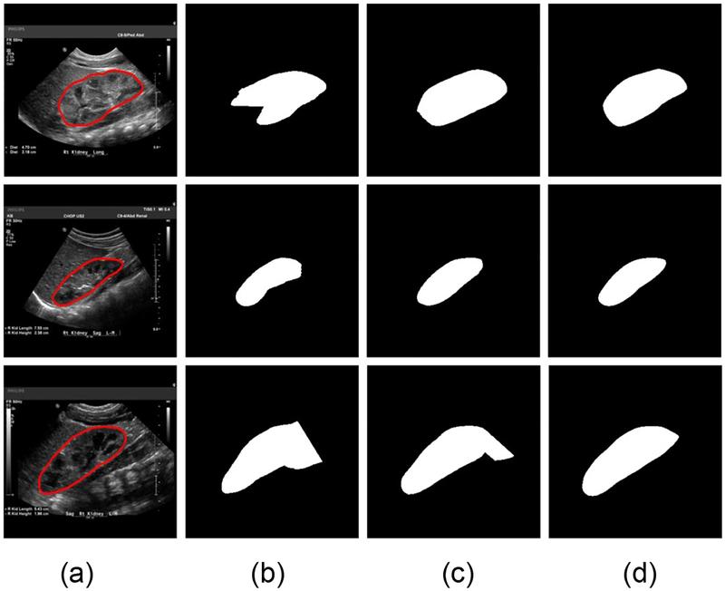 Fig. 11.