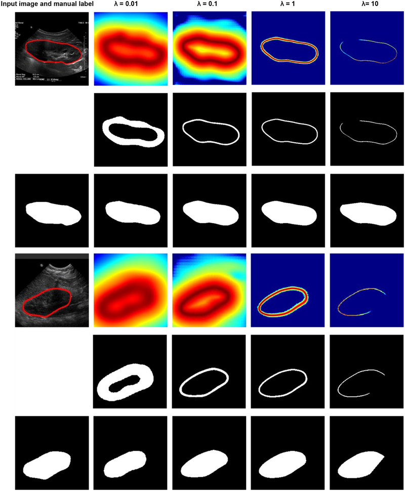 Fig. 12.