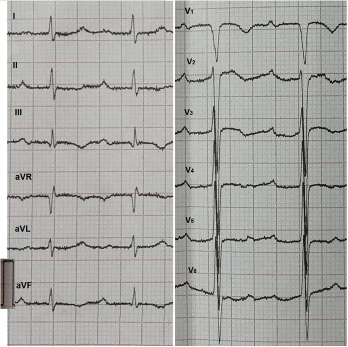 FIGURE 1