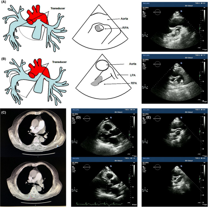 FIGURE 2