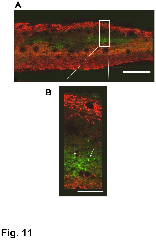 Figure 11