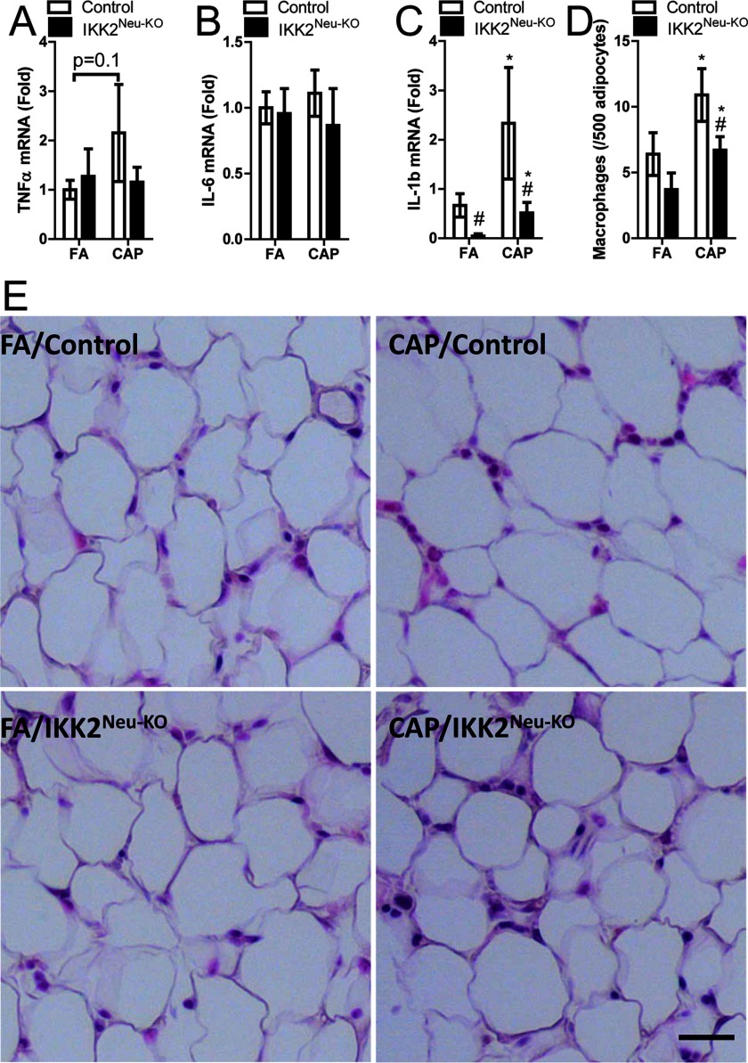 Figures 4A to 4D are stacked bar graphs with standard deviation plotting percentage of macrophages, TNF alpha mRNA (fold), IL 6 mRNA (fold), IL 1 beta mRNA (fold), and macrophages (per 500 adipocytes), respectively (y-axis), from male control mice and IKK2 super Neu KO mice as exposed to CAP and FA (x-axis). Figure 4E shows four photomicrographs of male control mice and IKK2 super Neu KO mice as exposed to CAP and FA.