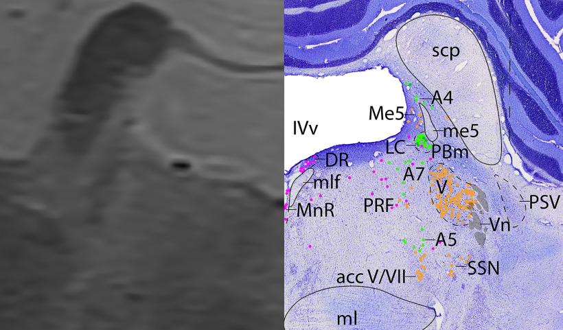 Figure 17.