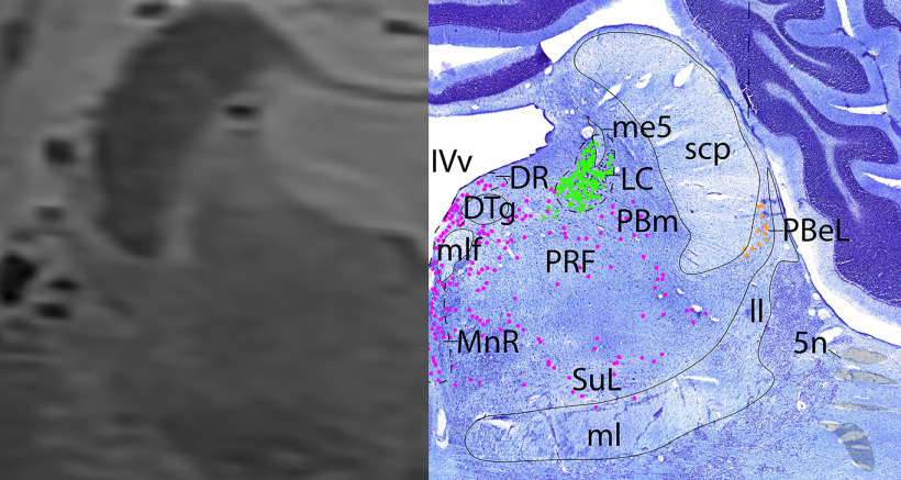 Figure 15.