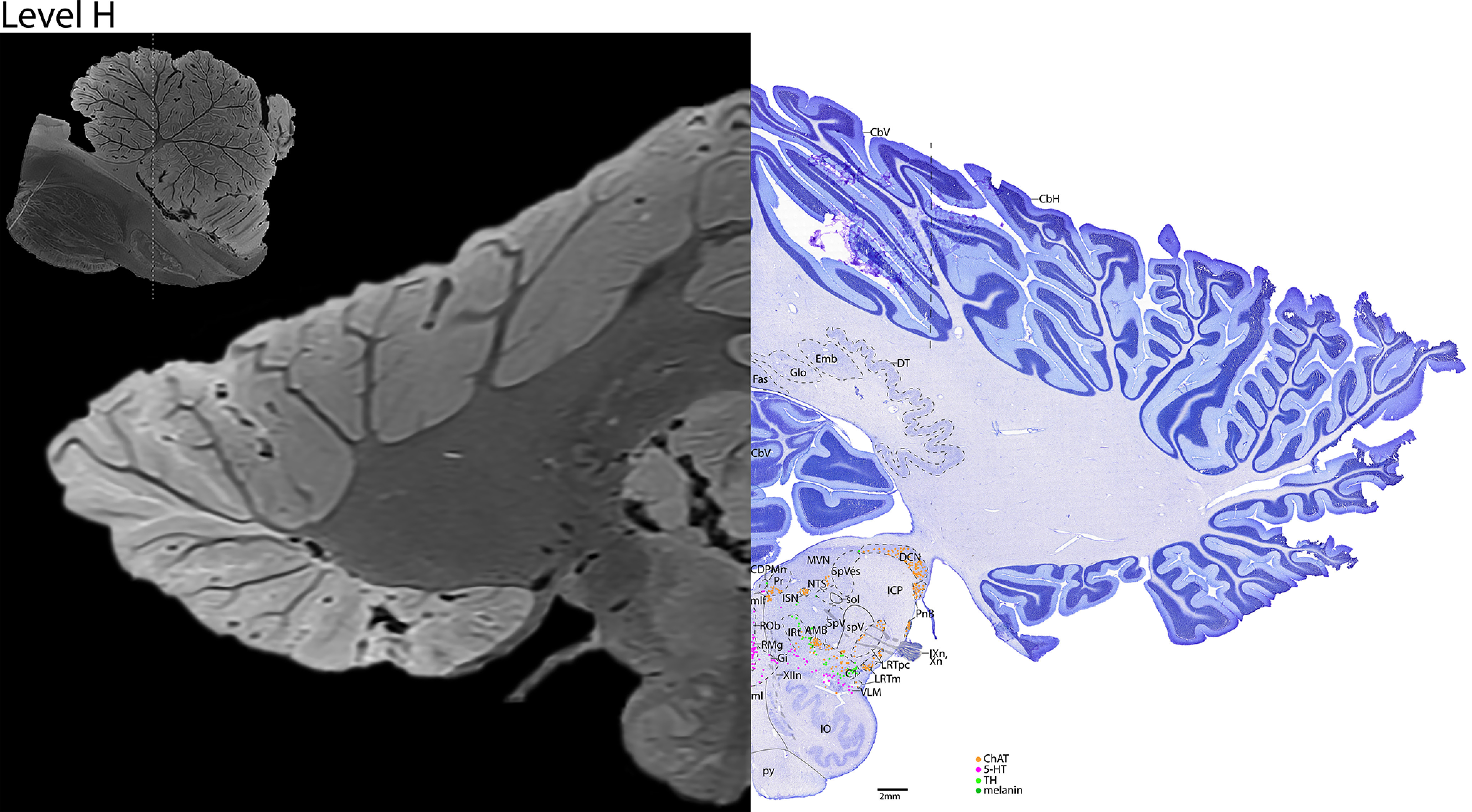 Figure 20.