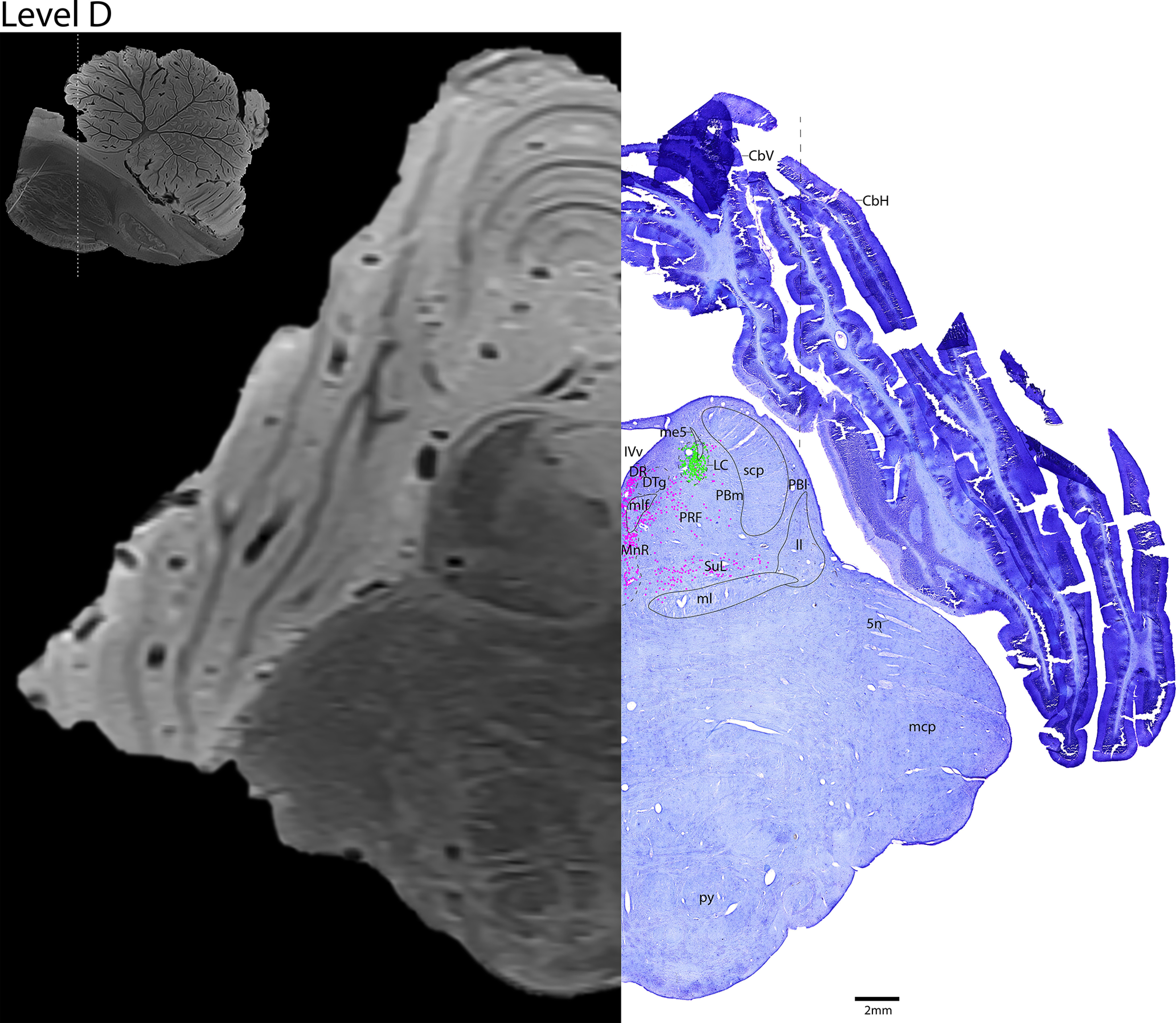 Figure 12.