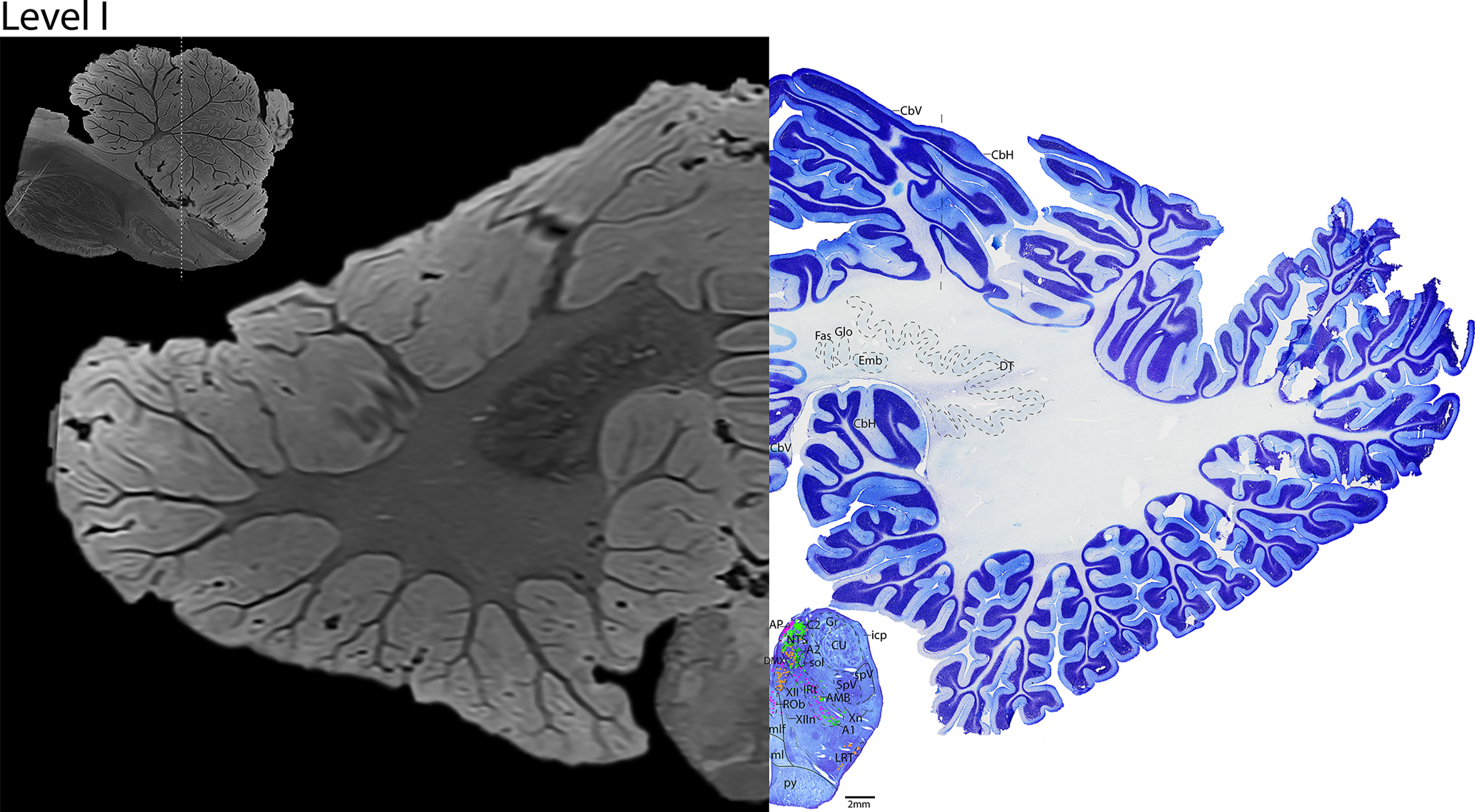 Figure 22.