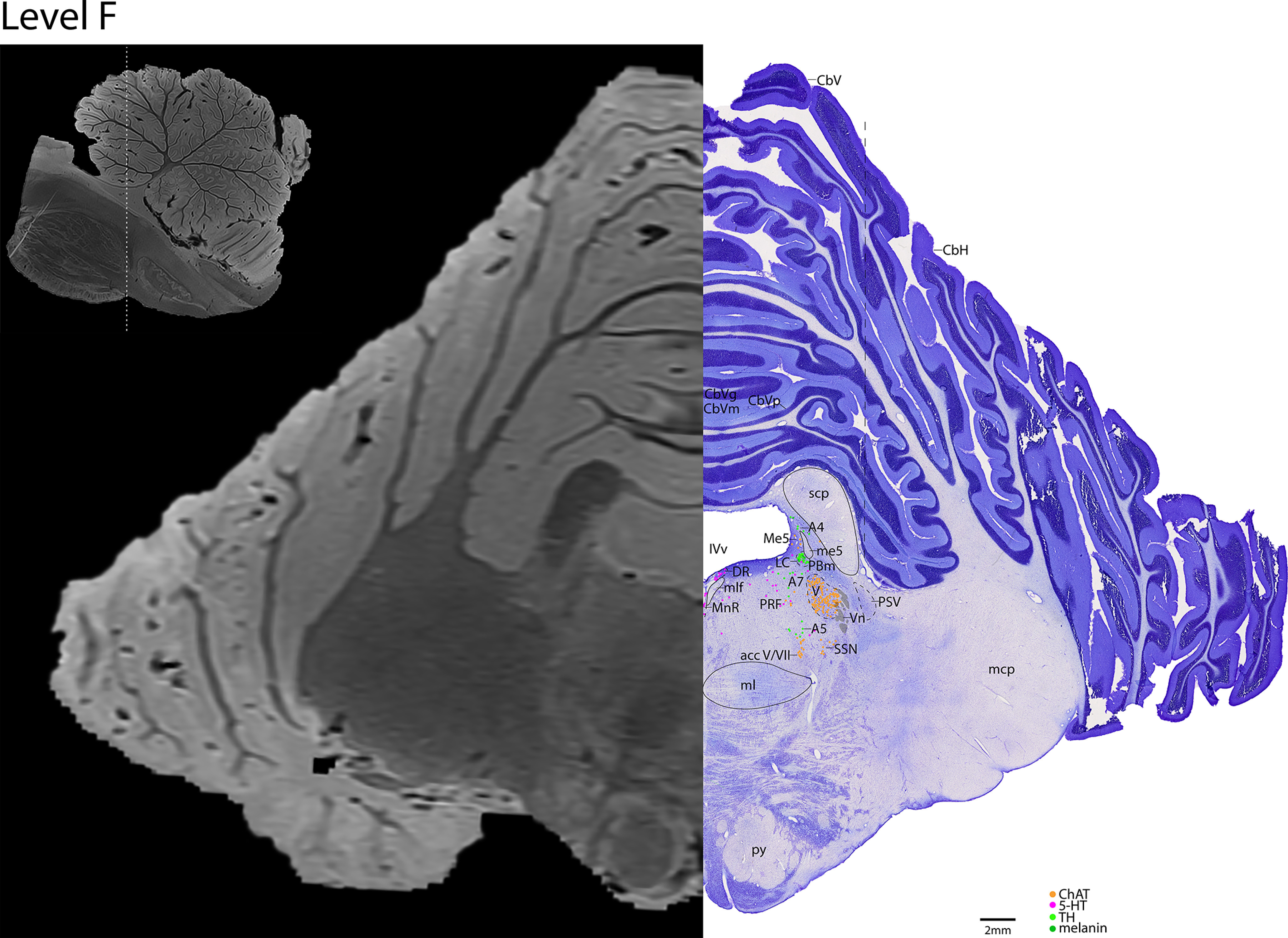 Figure 16.