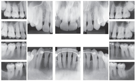 Figure 14