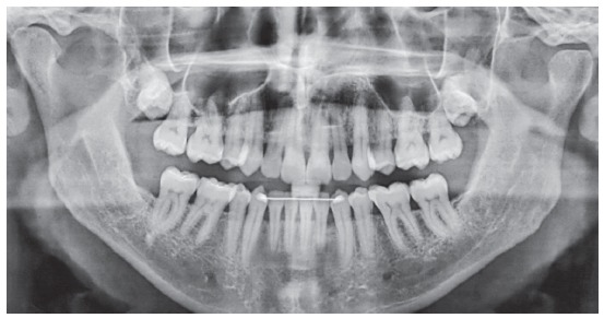 Figure 13