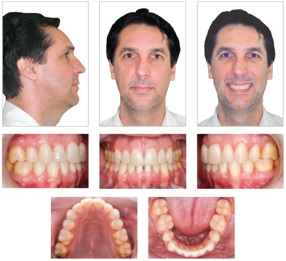 Figure 12
