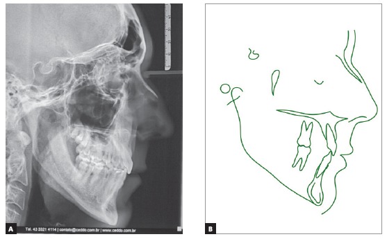Figure 15