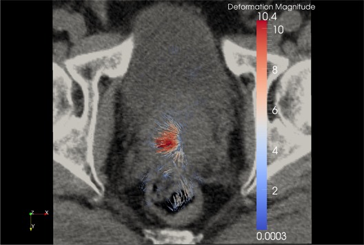 Figure 15