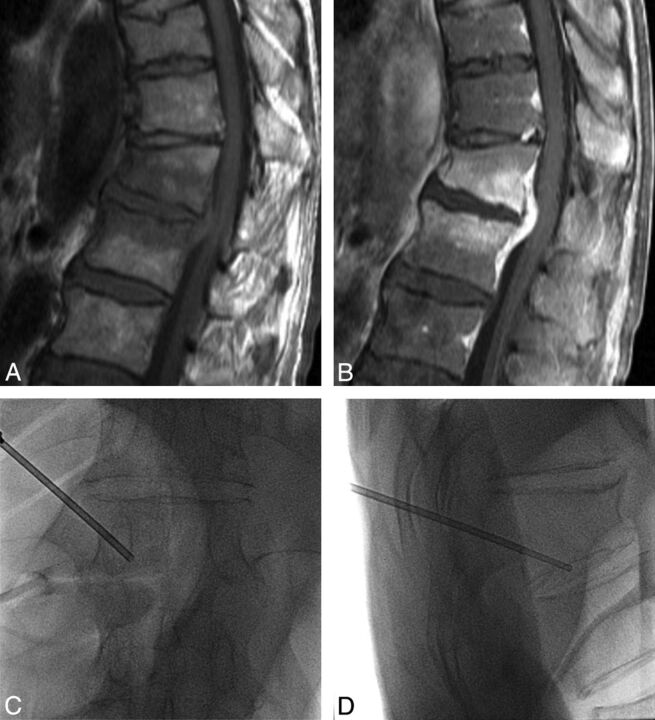 Fig 2.