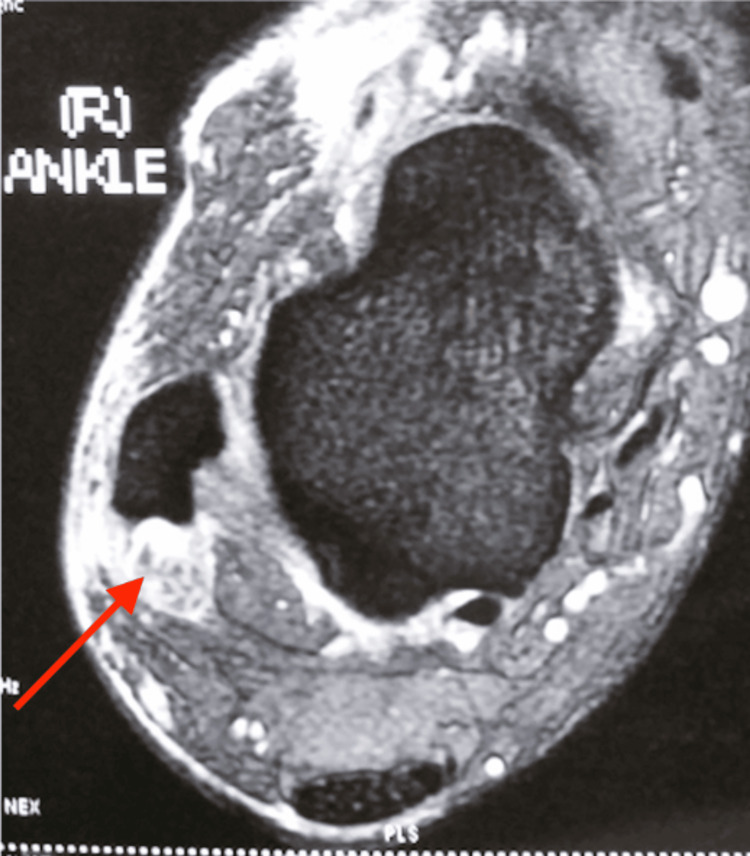 Figure 16