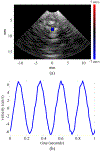 Fig. 15.