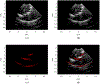 Fig. 13.