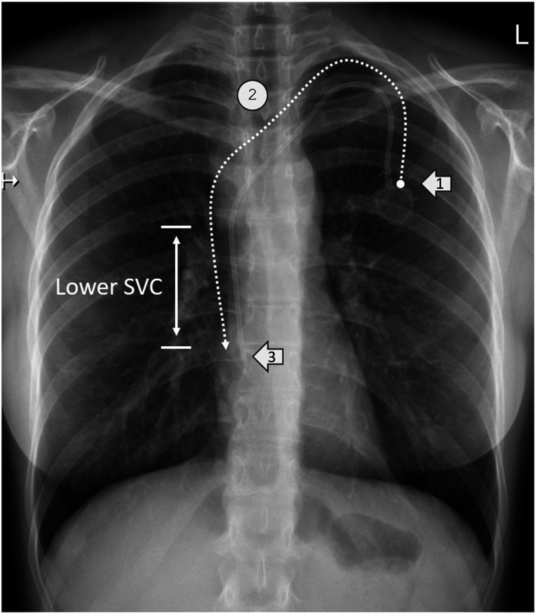 Fig. 3