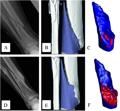 FIG. 6