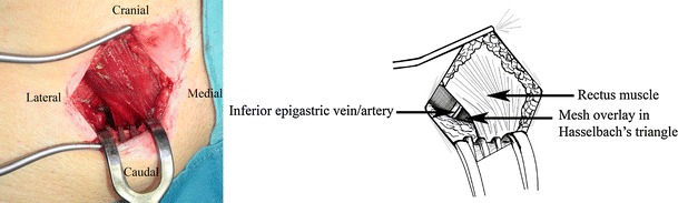 Fig. 1