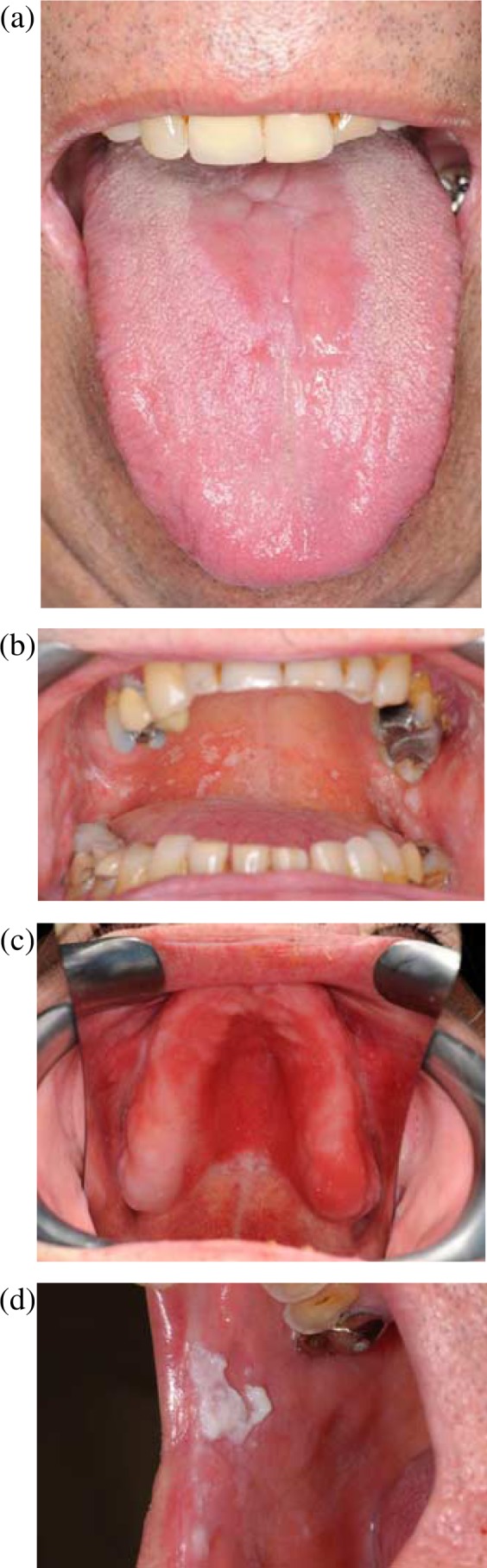 Fig. 1