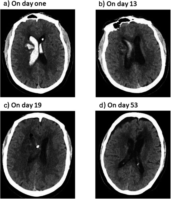 Fig. 1