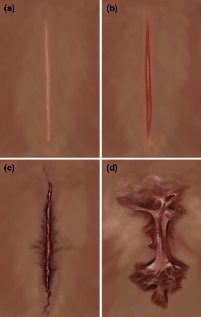 Fig. 1