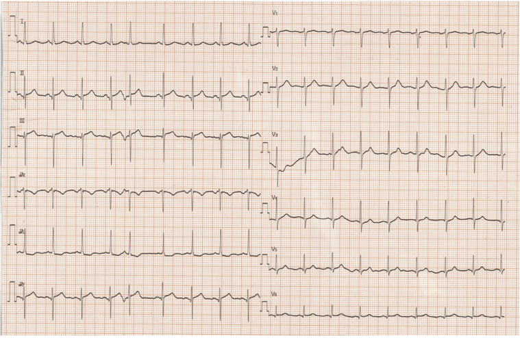 Figure 2