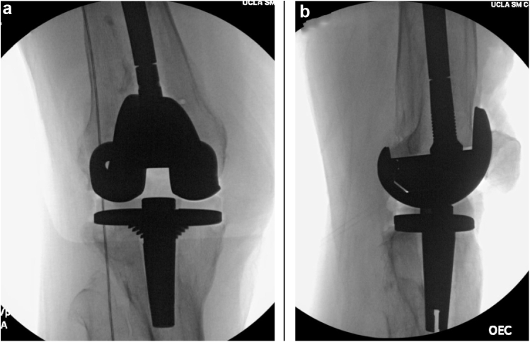 Figure 3