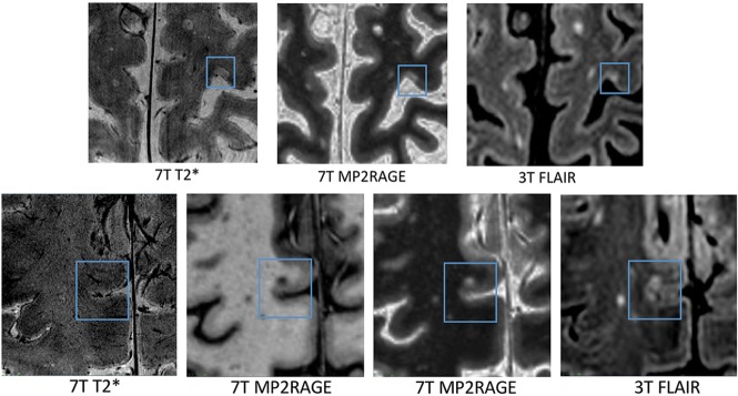 Fig 3.