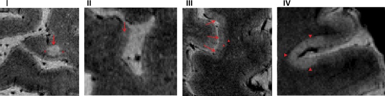 Fig 2.