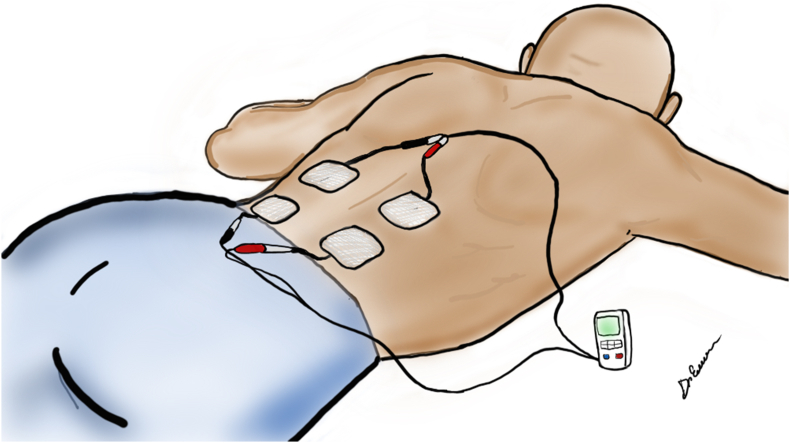 Fig. 4