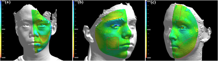 FIGURE 2