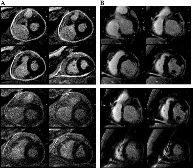 Fig. 11