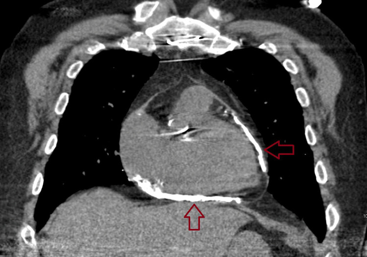 Fig. 9