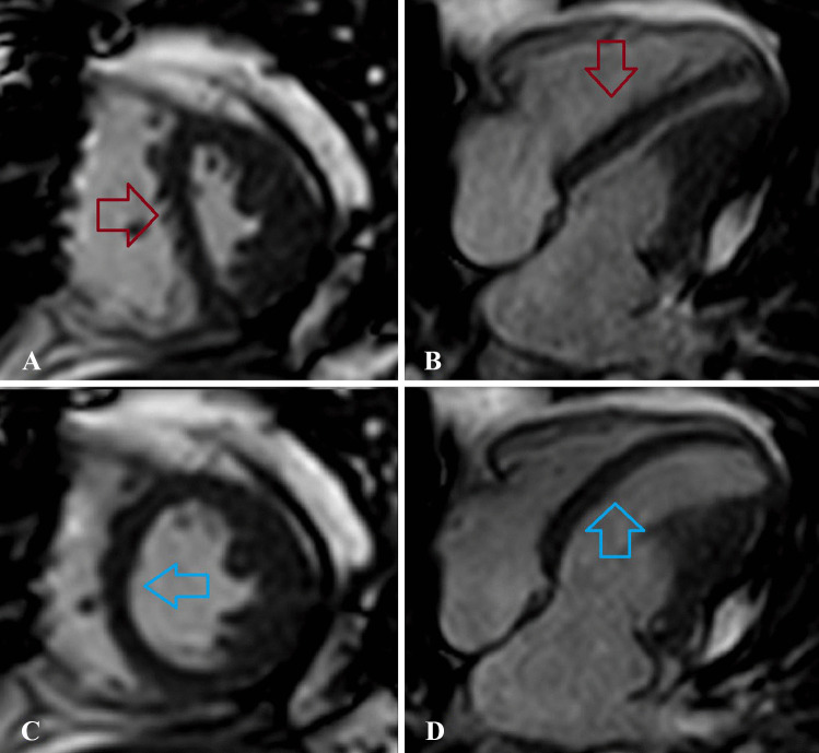 Fig. 10