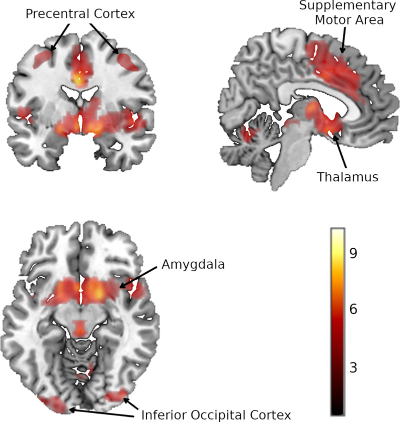 Fig 2