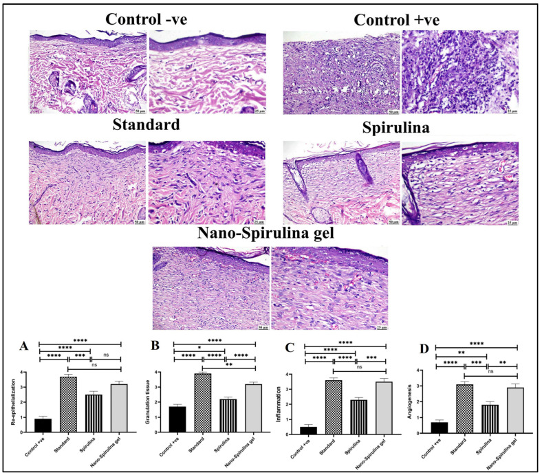 Figure 12