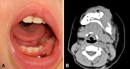 Fig. 1