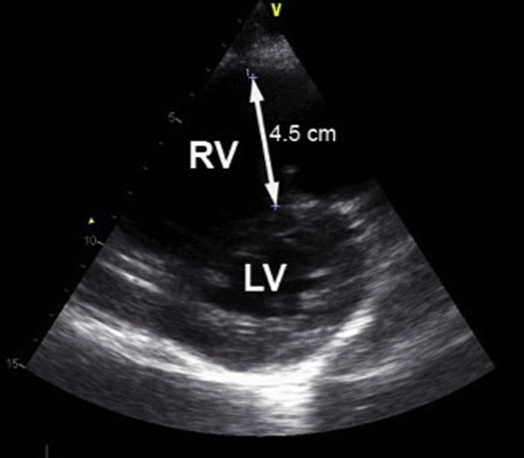 Figure 3