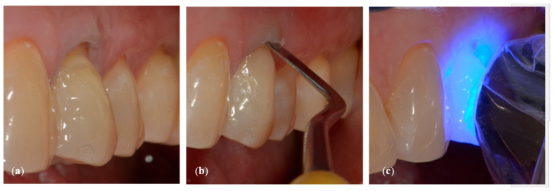 Figure 6