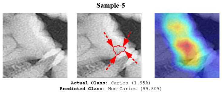 Figure 12