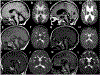 FIG. 1.